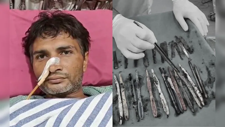 Doctors remove 29 spoons, 19 toothbrushes from patient’s stomach