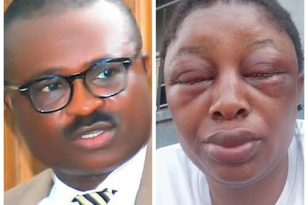 Police arrest Cross River lawmaker over domestic violence, wife battery