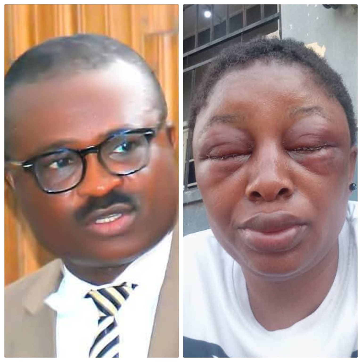 Police arrest Cross River lawmaker over domestic violence, wife battery