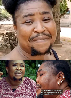 I want to look different, woman living with facial hair shares story