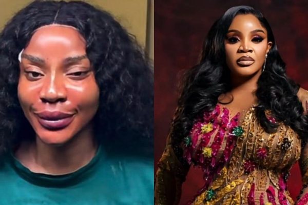 ‘I got me a new face’ – Uche Ogbodo announces threads, fillers, PDO treatments