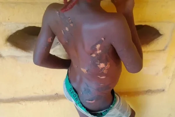 Police arrest mother for burning daughter with hot knife