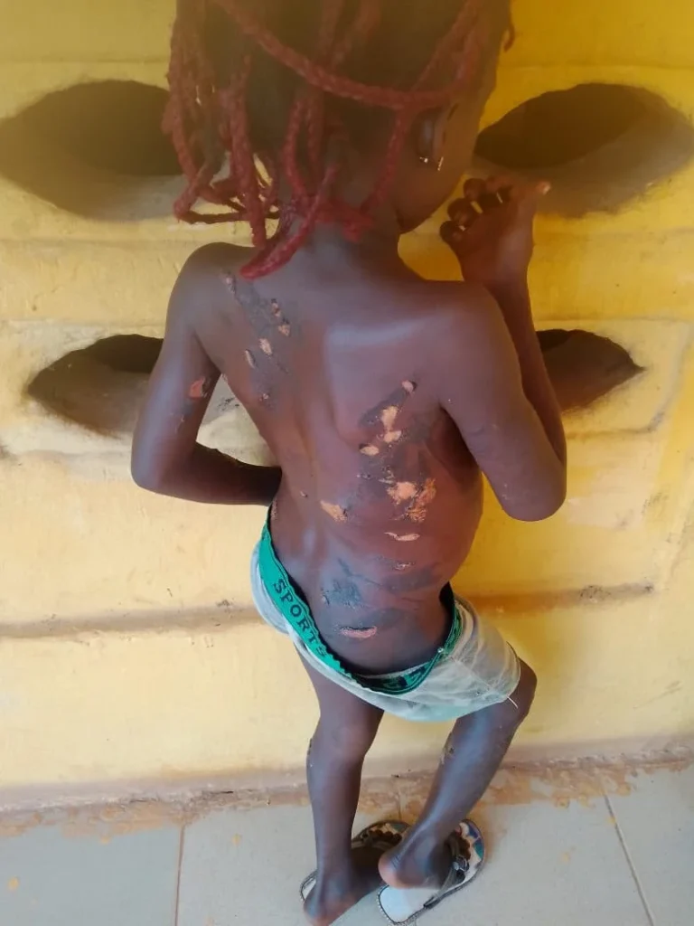 Police arrest mother for burning daughter with hot knife